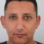 6 bf - Landing Otoplasty Correction 53